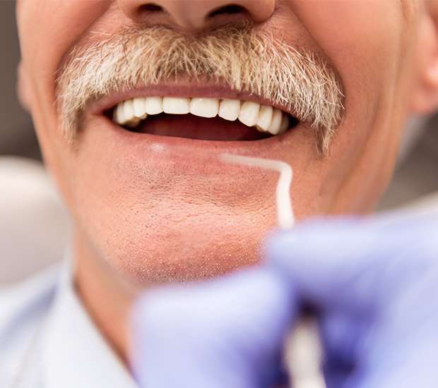 Laurel Springs Adjusting to New Dentures