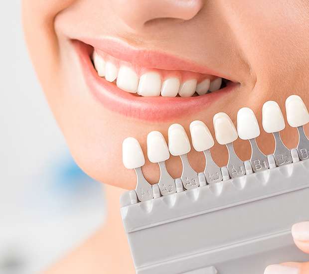 Laurel Springs Dental Veneers and Dental Laminates